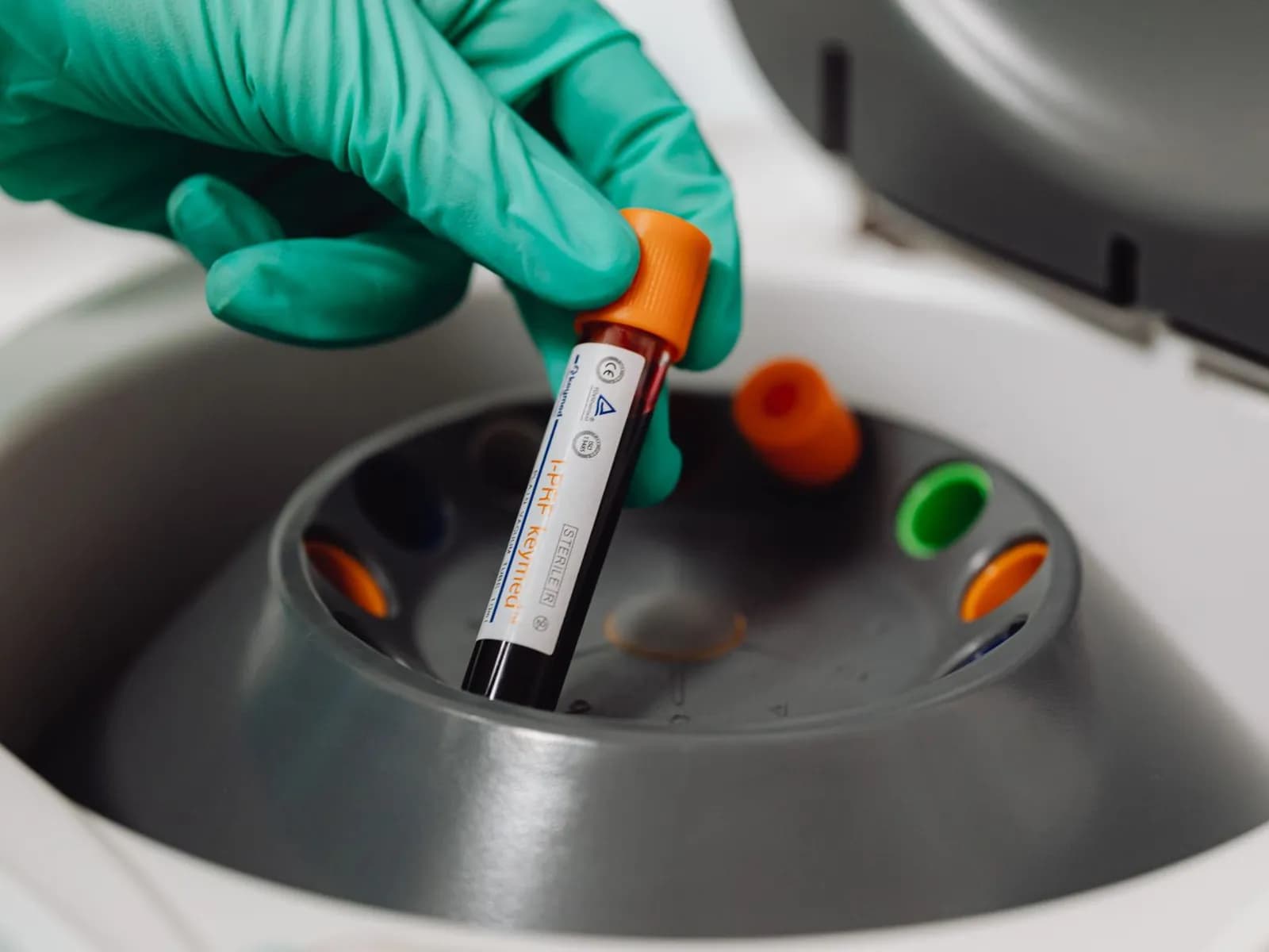 Blood sample tube being placed in a laboratory centrifuge